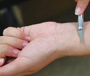 Pour ou contre la mutilation?